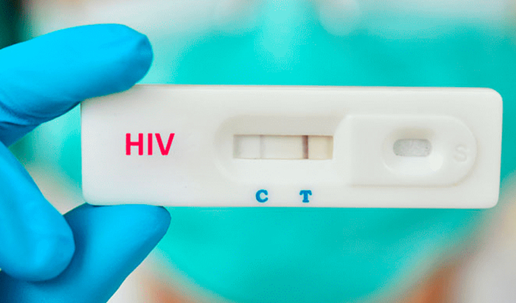 Causas relacionadas à aids matam uma pessoa por minuto no mundo