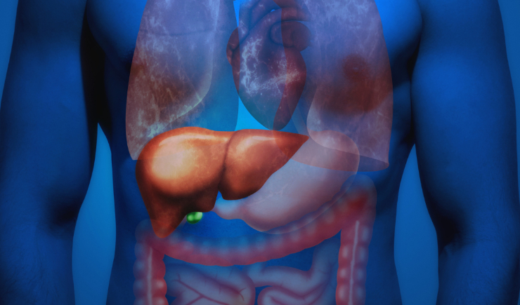 Primeiro medicamento no mundo para forma grave de doença hepática gordurosa é aprovado pela FDA